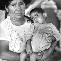 Woman holding a malnourished child.