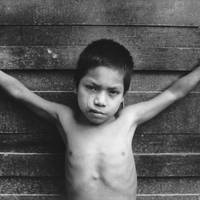 A boy from the religious mission located in Puerto Ocopa, Satipo, displays a large scar made by a terrorist commander